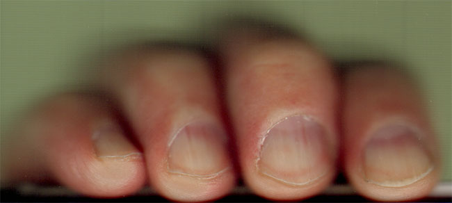 geknipte nagels