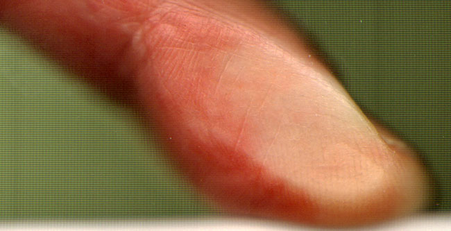 zijkant vinger...