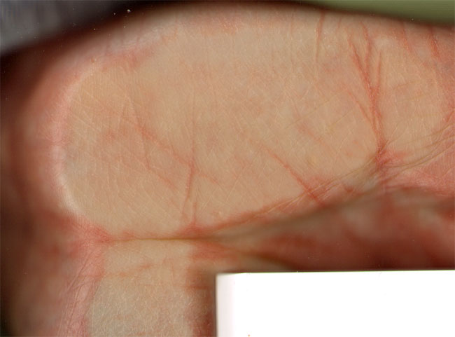 handpalm