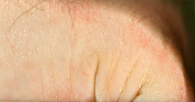 zijkant van de hand