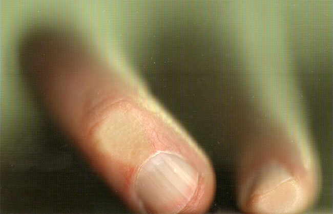 gekromde vingers
