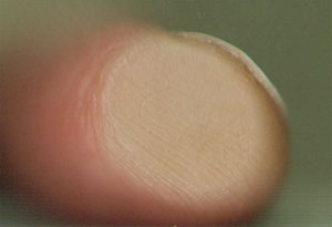 per ongeluk meegescande handen – 20