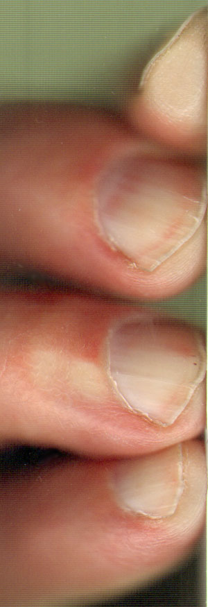 niet geheel schone nagels...