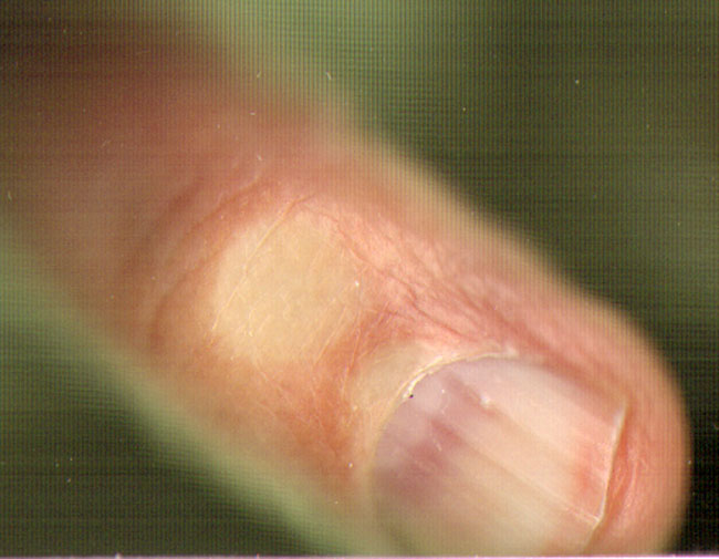 de rimpels in een vinger...