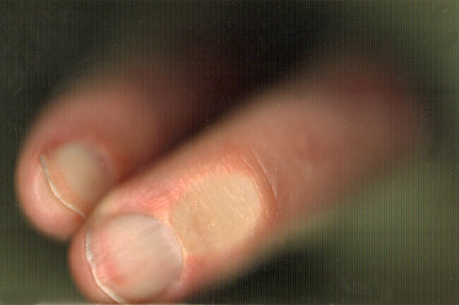 vieze nagels...