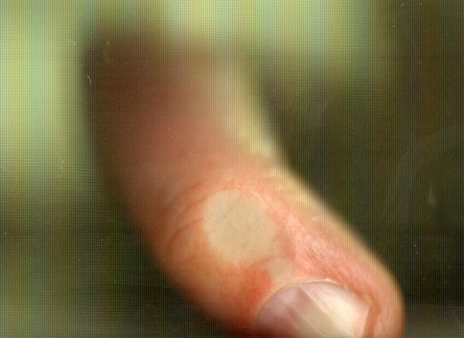 een kromme vinger