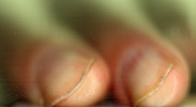 hmmm... vieze nagels...