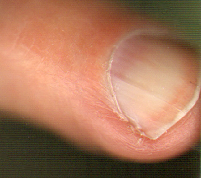 close up