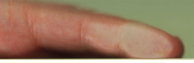 1 vinger