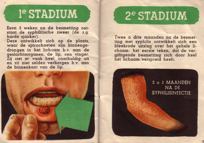 een paar afschrikwekkende plaatjes...