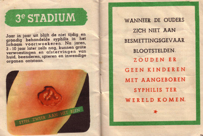zwerend been...