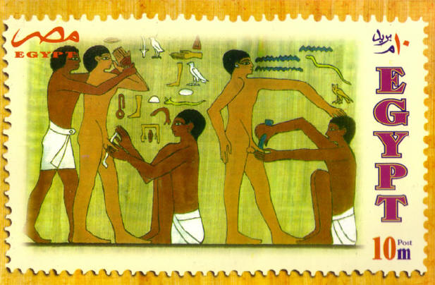 penisbehandeling in egypte...