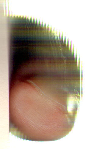 vinger
