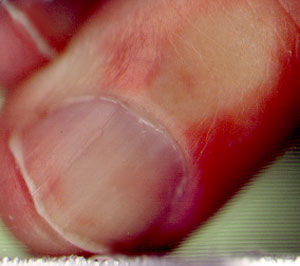slordig geknipte nagels...