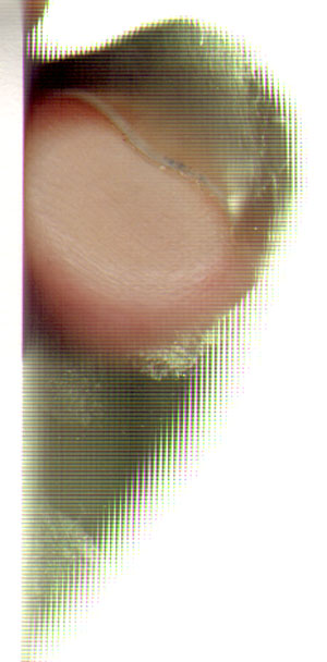 vieze nagel, vies glas