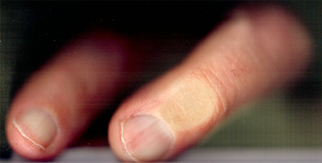 slordig geknipte nagels...