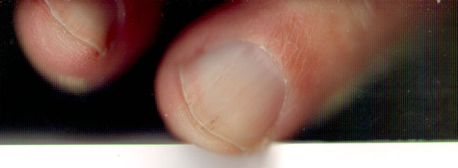 vinger over de rand...