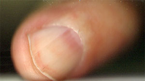 vintertop