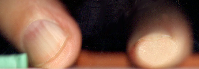 vies glas...