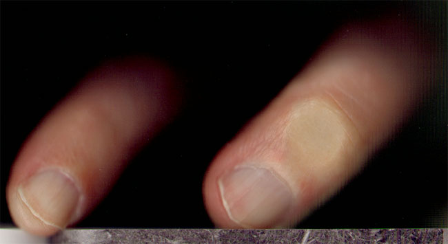 vinger over de rand...