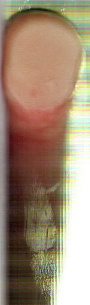 platgedrukte vingertop en vies glas...
