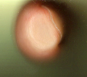 vingertop