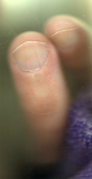 nagelrandjes...
