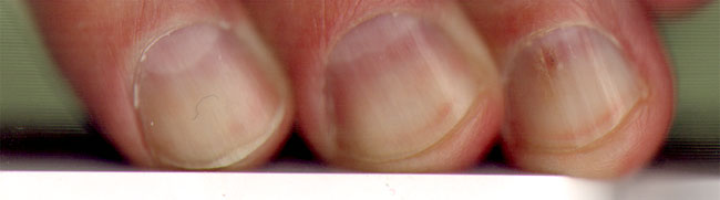 kortgeknipte nagels...