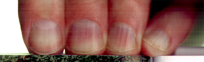 nagels..