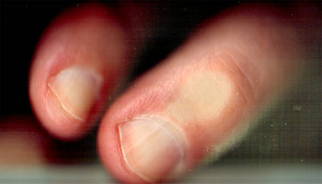 kortgeknipte nagels