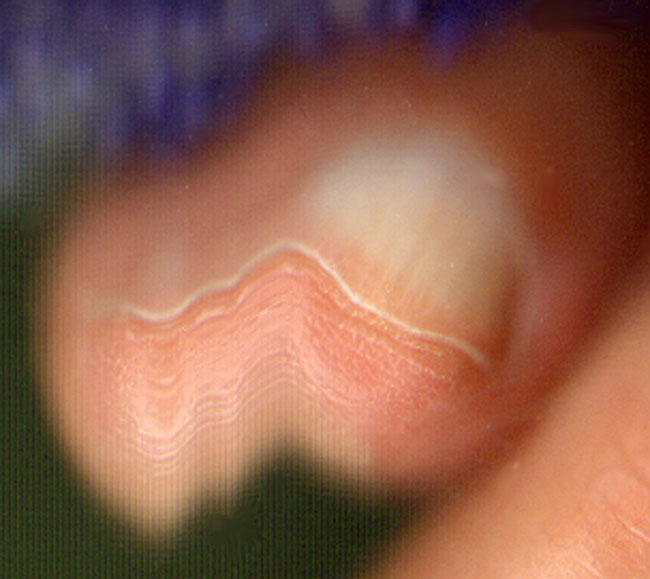 bewogen vinger