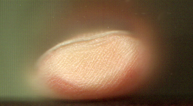 bleke vingertop