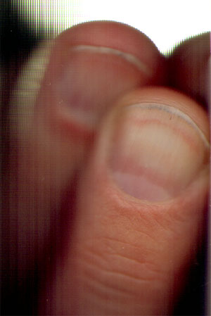 vuile nagels...