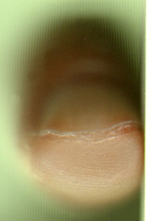 nagelrand