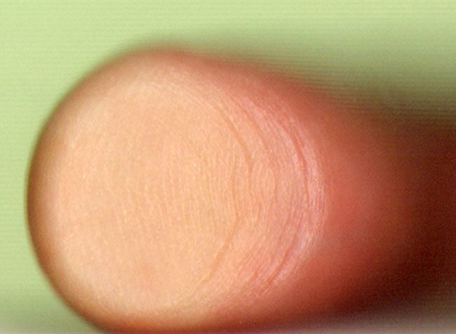 science fictionvinger...