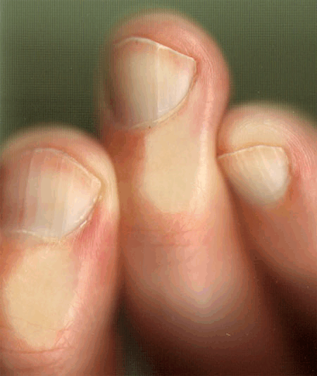 van drie vingers naar…